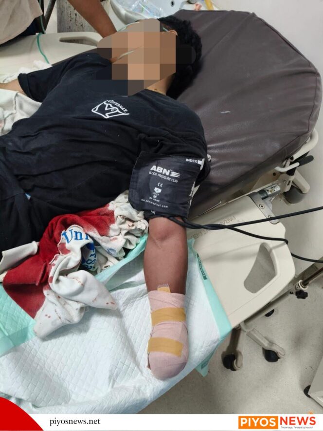 
					Seorang Pelajar Jadi Korban Begal Hingga Pergelengan Tangan Putus, HP dan Sepeda Motor Raib 